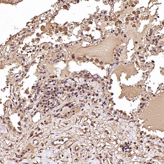 IHC - Anti-NAK/TBK1 (N-term) Rabbit Monoclonal Antibody ABO14234